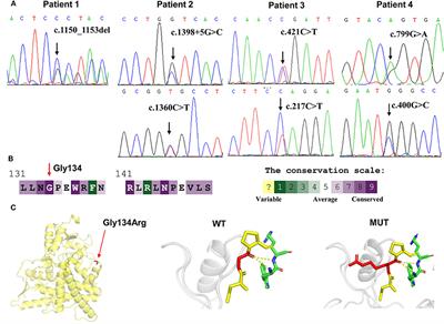 Clinical and Molecular Analysis of Four Patients With 11β-Hydroxylase Deficiency